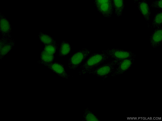 THYN1 Antibody in Immunocytochemistry (ICC/IF)