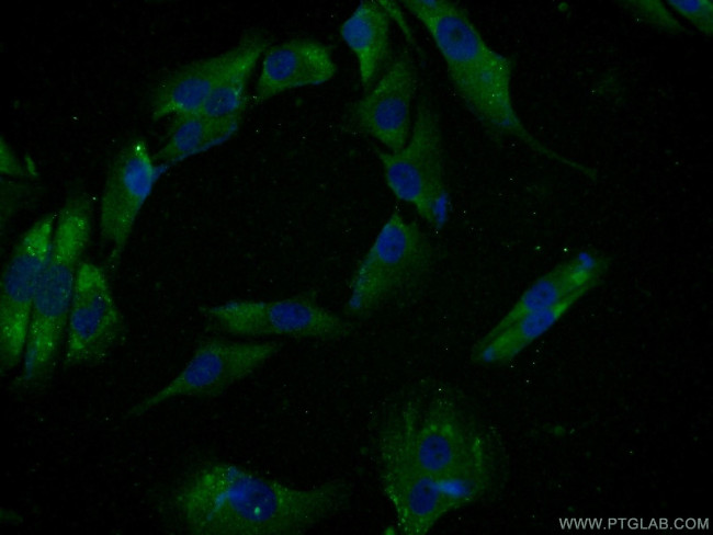 SPANXE Antibody in Immunocytochemistry (ICC/IF)