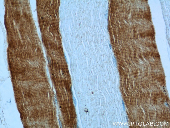 TNNC2 Antibody in Immunohistochemistry (Paraffin) (IHC (P))