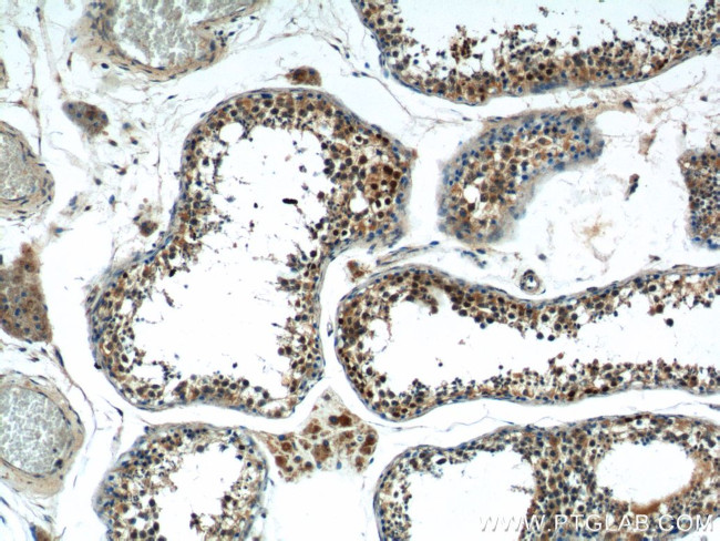 SSX4 Antibody in Immunohistochemistry (Paraffin) (IHC (P))