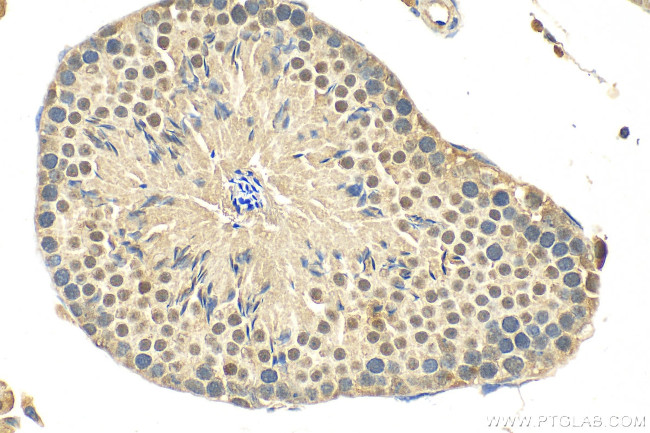 LSM3 Antibody in Immunohistochemistry (Paraffin) (IHC (P))