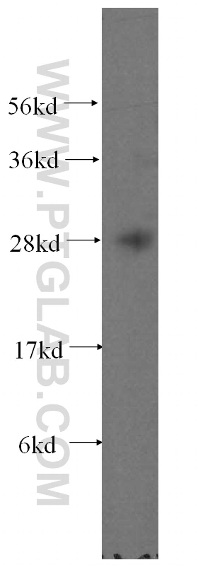 FKBP14 Antibody in Western Blot (WB)