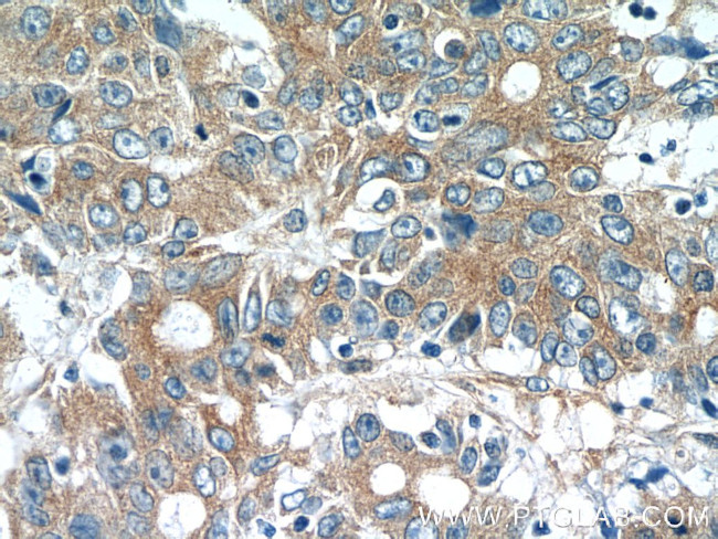 MOBKL3 Antibody in Immunohistochemistry (Paraffin) (IHC (P))