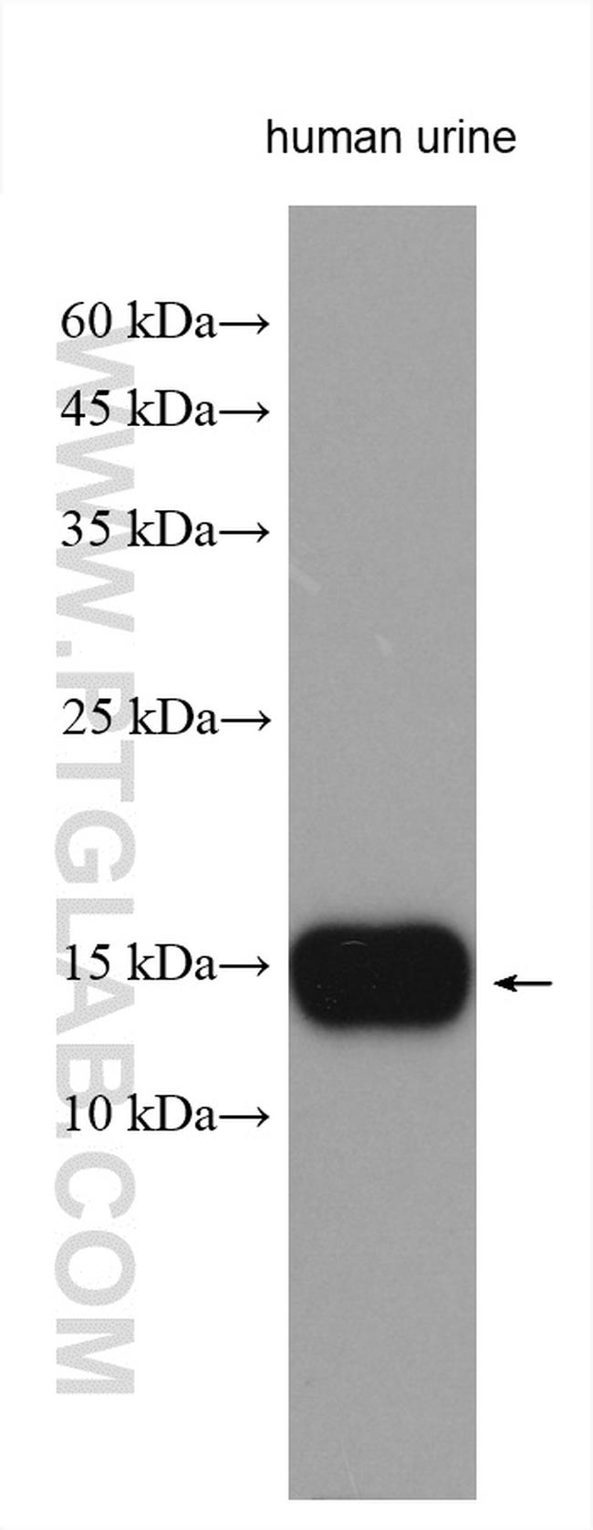 MSMB Antibody in Western Blot (WB)