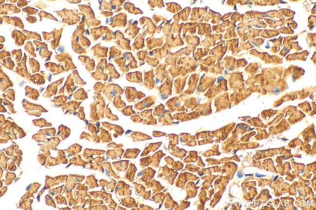 NDUFA2 Antibody in Immunohistochemistry (Paraffin) (IHC (P))