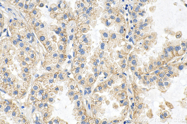 INPP4B Antibody in Immunohistochemistry (Paraffin) (IHC (P))