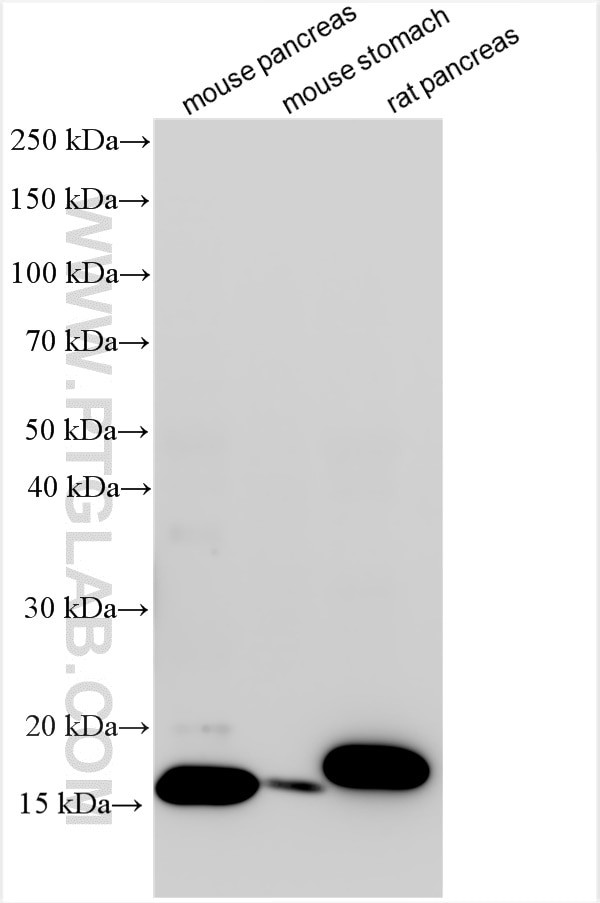 RNASE1 Antibody in Western Blot (WB)