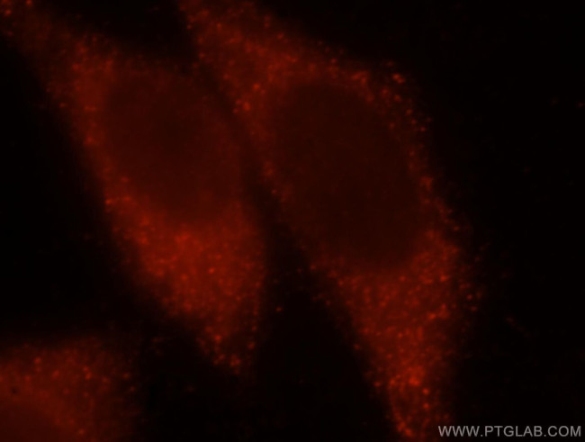 CALML4 Antibody in Immunocytochemistry (ICC/IF)