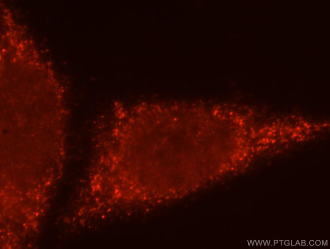 BTN3A3 Antibody in Immunocytochemistry (ICC/IF)