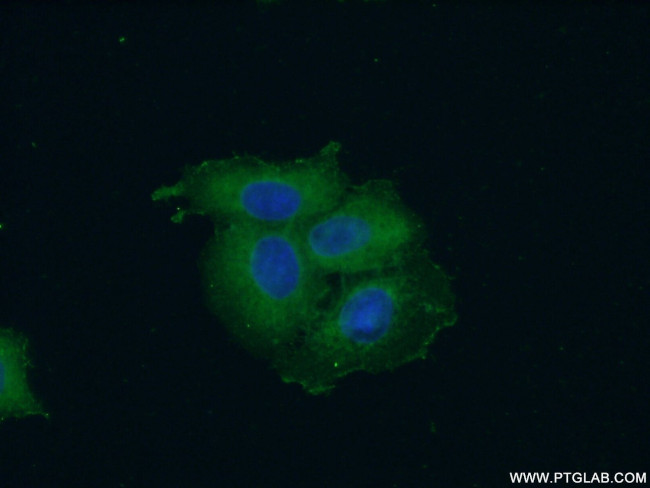 SH3GLB2 Antibody in Immunocytochemistry (ICC/IF)