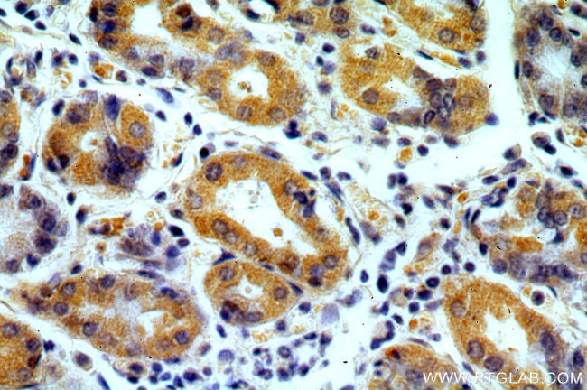 MRPS2 Antibody in Immunohistochemistry (Paraffin) (IHC (P))