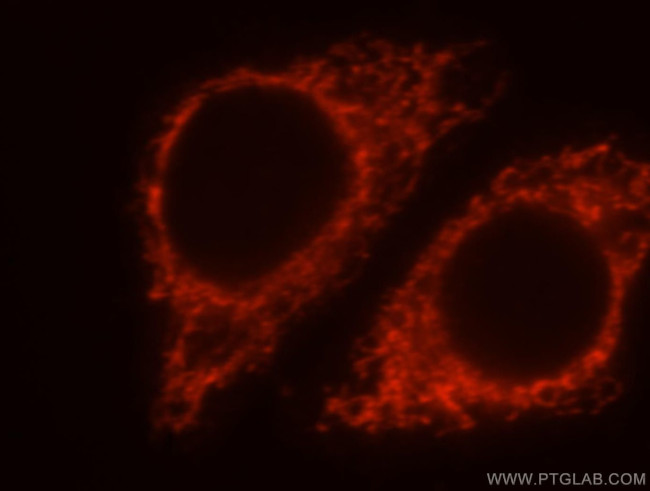 MRPL38 Antibody in Immunocytochemistry (ICC/IF)