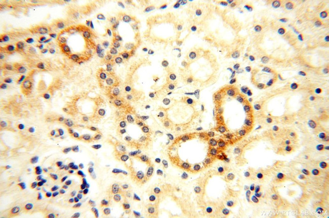 Semenogelin-1 Antibody in Immunohistochemistry (Paraffin) (IHC (P))