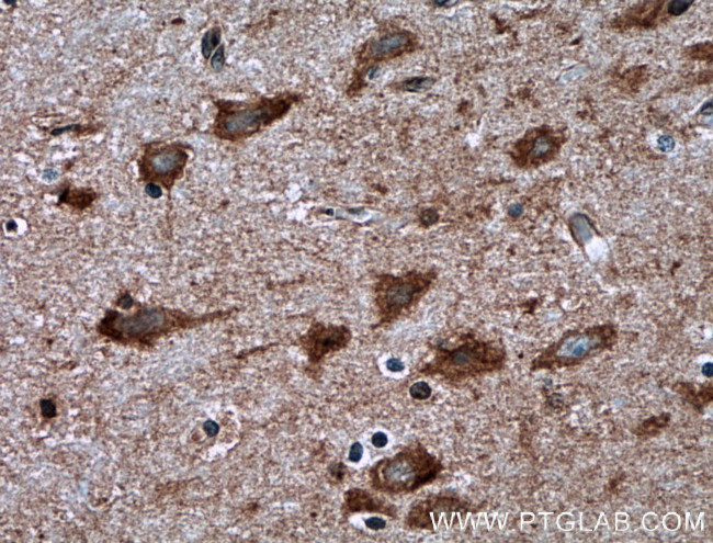 RHEB Antibody in Immunohistochemistry (Paraffin) (IHC (P))