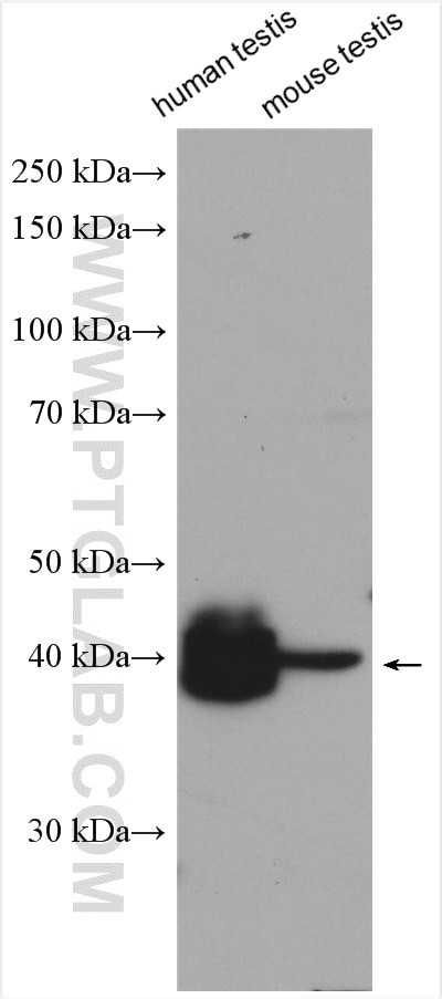 ART3 Antibody in Western Blot (WB)