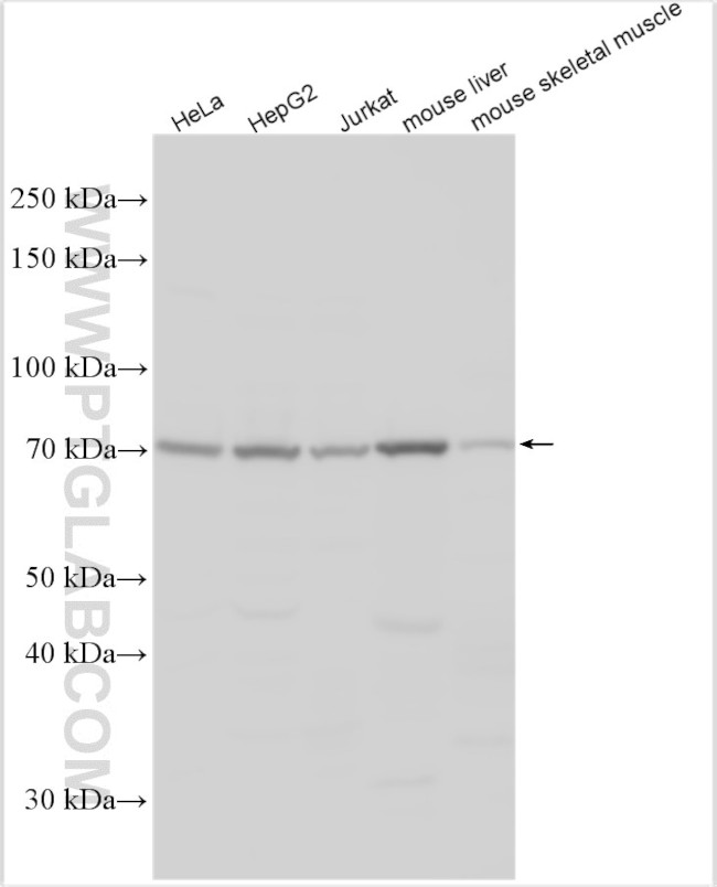 ABCD4 Antibody in Western Blot (WB)