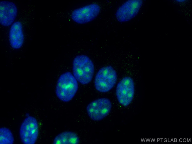 EXOSC4 Antibody in Immunocytochemistry (ICC/IF)