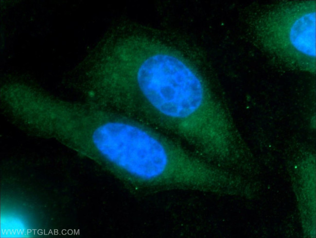 TIPE2 Antibody in Immunocytochemistry (ICC/IF)