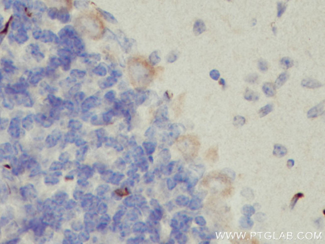 TMEM50B Antibody in Immunohistochemistry (Paraffin) (IHC (P))