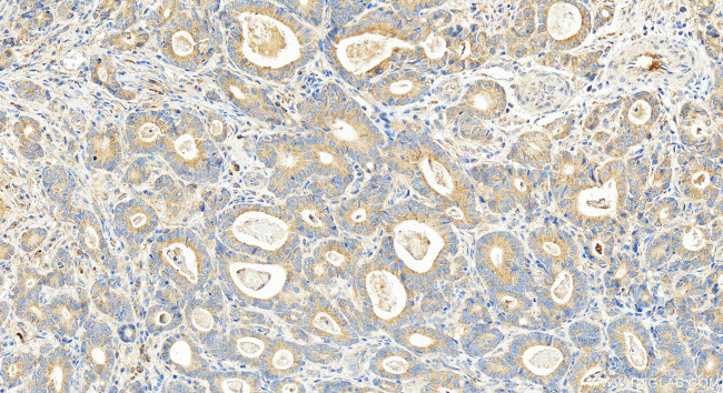 RPS11 Antibody in Immunohistochemistry (Paraffin) (IHC (P))