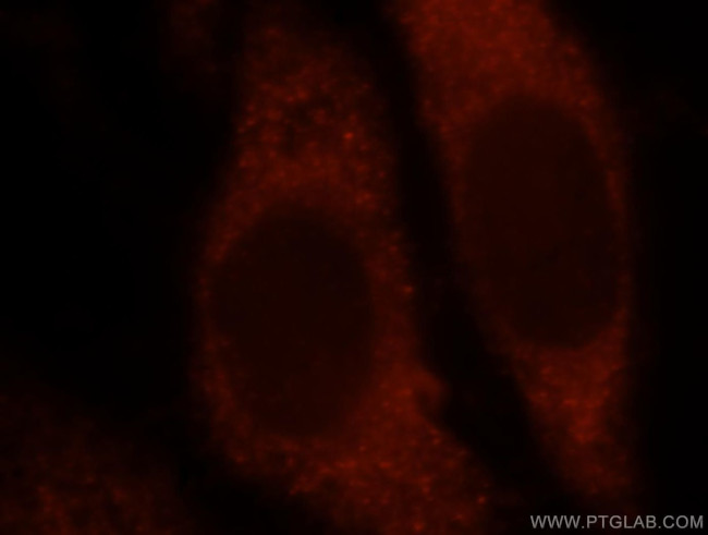 MAT2B Antibody in Immunocytochemistry (ICC/IF)