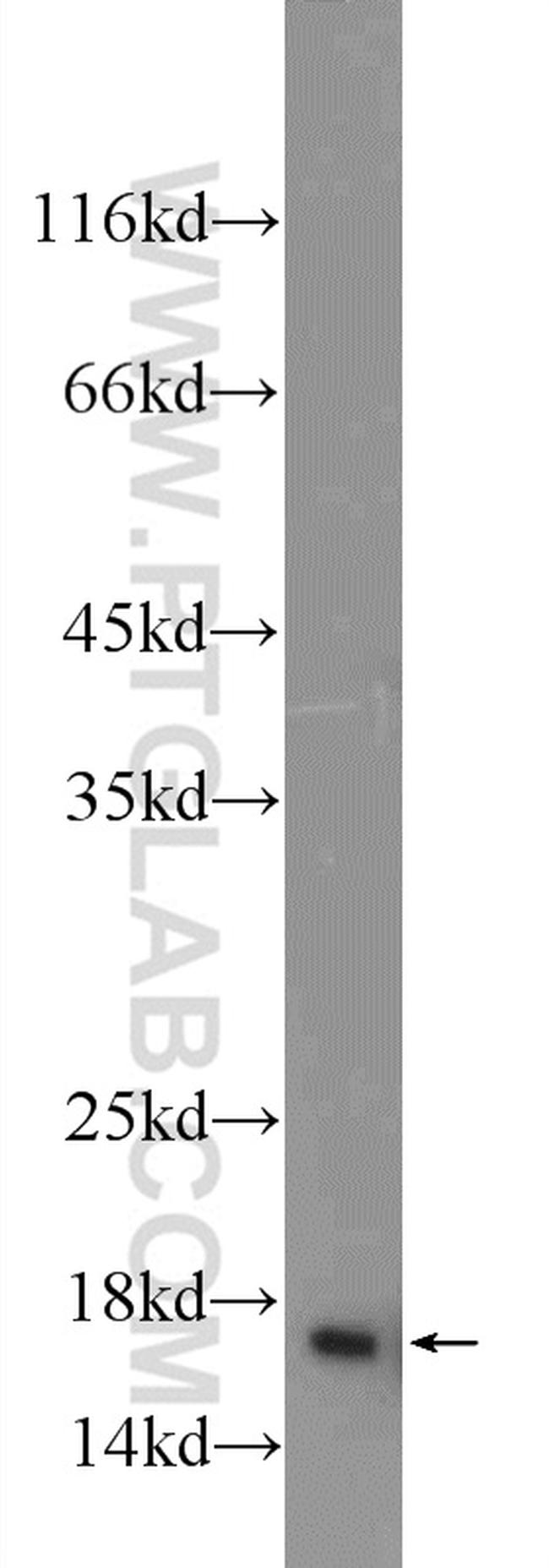 HIST1H2AC Antibody in Western Blot (WB)
