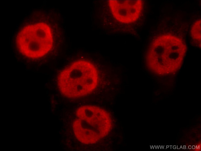 FIBP Antibody in Immunocytochemistry (ICC/IF)