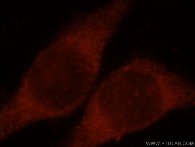 CLIC3 Antibody in Immunocytochemistry (ICC/IF)