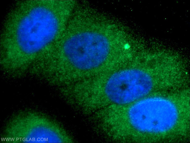 TELO2 Antibody in Immunocytochemistry (ICC/IF)