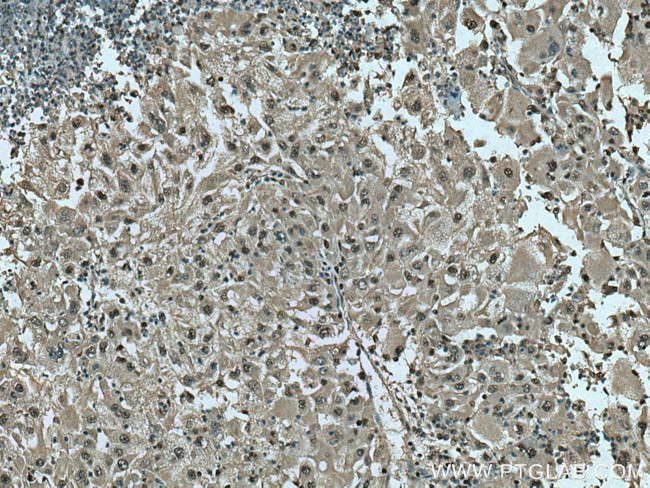 PSMB10 Antibody in Immunohistochemistry (Paraffin) (IHC (P))