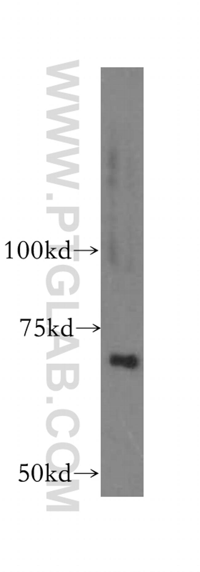 PAPSS2 Antibody in Western Blot (WB)