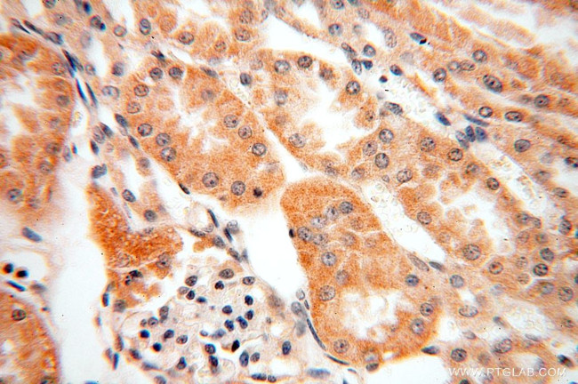 SFXN2 Antibody in Immunohistochemistry (Paraffin) (IHC (P))