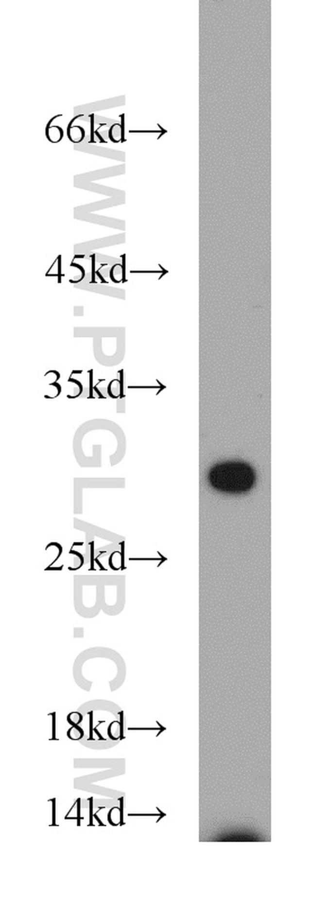 NUS1 Antibody in Western Blot (WB)