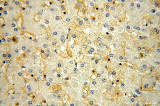 KCNJ15 Antibody in Immunohistochemistry (Paraffin) (IHC (P))