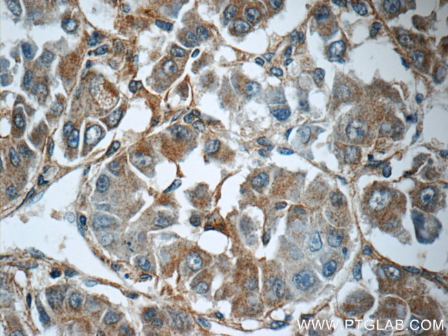 MRPS26 Antibody in Immunohistochemistry (Paraffin) (IHC (P))