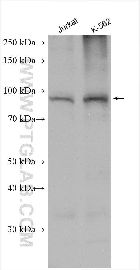 TRPV2 Antibody in Western Blot (WB)