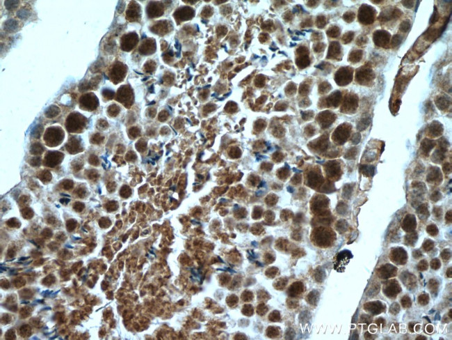 RTCD1 Antibody in Immunohistochemistry (Paraffin) (IHC (P))