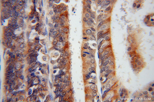 Syntaxin 18 Antibody in Immunohistochemistry (Paraffin) (IHC (P))