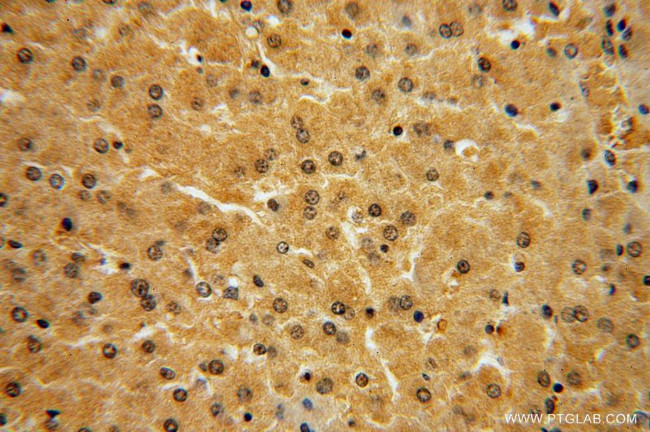 NAP1L4 Antibody in Immunohistochemistry (Paraffin) (IHC (P))