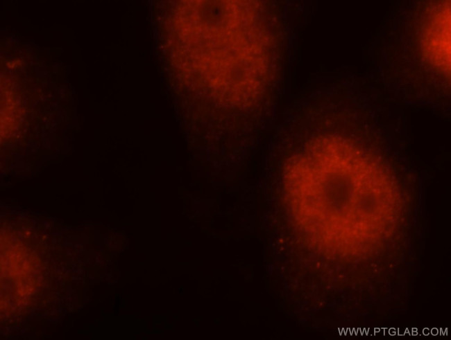 DBR1 Antibody in Immunocytochemistry (ICC/IF)