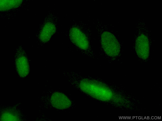 MANBAL Antibody in Immunocytochemistry (ICC/IF)