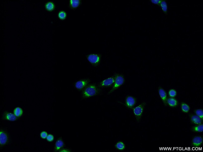 ERGIC3 Antibody in Immunocytochemistry (ICC/IF)