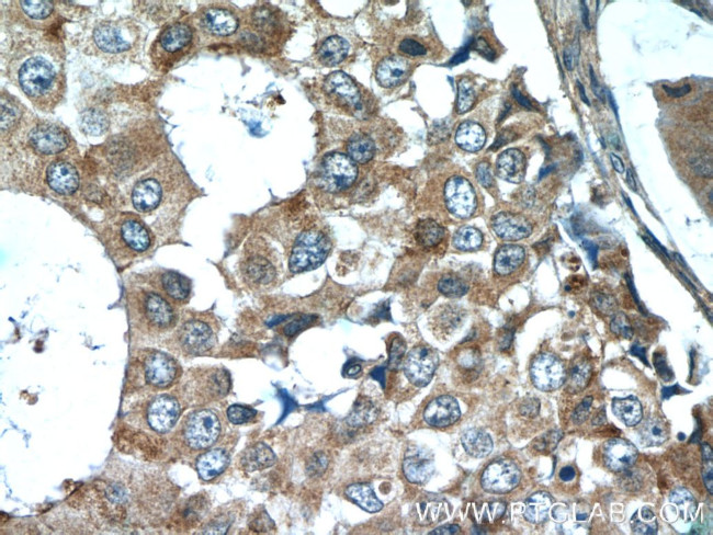 CSN3 Antibody in Immunohistochemistry (Paraffin) (IHC (P))