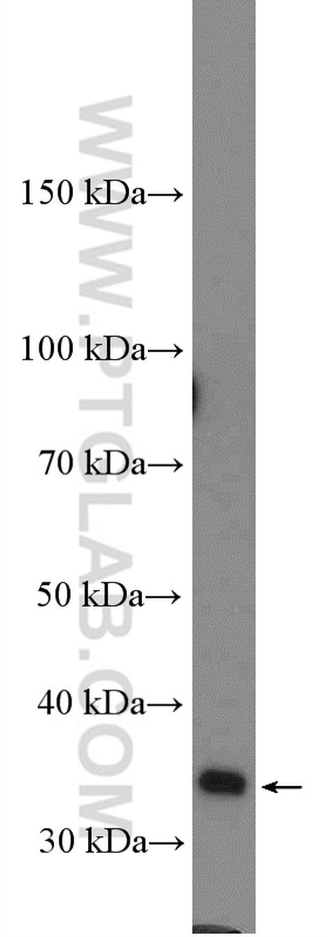 TUSC3 Antibody in Western Blot (WB)