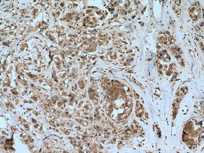 PFDN4 Antibody in Immunohistochemistry (Paraffin) (IHC (P))