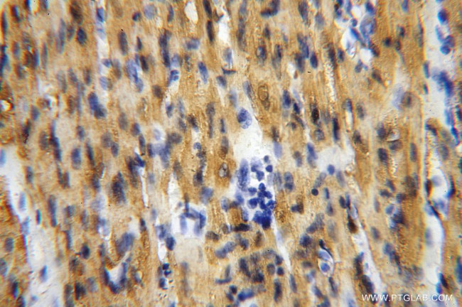 Myoglobin Antibody in Immunohistochemistry (Paraffin) (IHC (P))