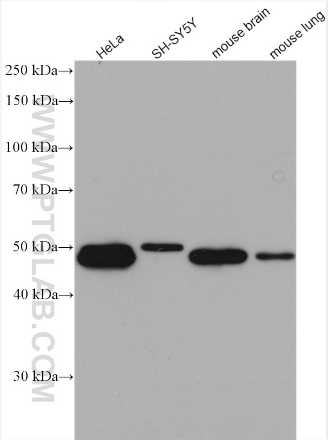 SNX15 Antibody in Western Blot (WB)