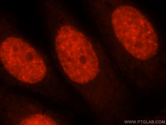 MYEF2 Antibody in Immunocytochemistry (ICC/IF)