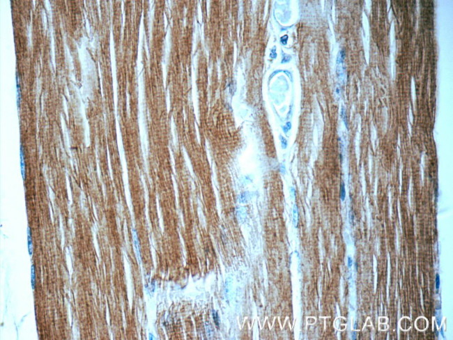 MYLPF Antibody in Immunohistochemistry (Paraffin) (IHC (P))