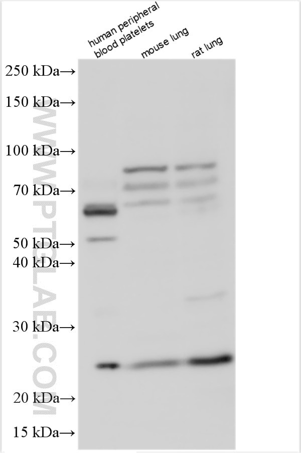 SAP30L Antibody in Western Blot (WB)